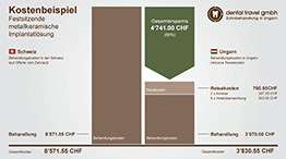 Preisvergleich von Kosten für festsitzende metallkeramische Implantatlösung, Schaubild der Kosten in Deutschland und der Schweiz