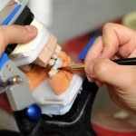 Dentaltechnik - dreidimensionales Modell