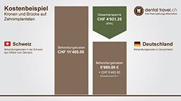 Preisvergleich von Kosten für Zahnimplantate mit Knochenaufbau, Schaubild der Kosten in Deutschland und der Schweiz