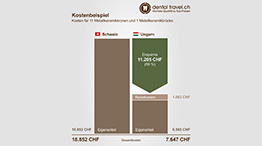 Preisvergleich für elf Metallkeramikkronen und eine Metallkeramikbrücke, Schaubild der Kosten in Ungarn und der Schweiz
