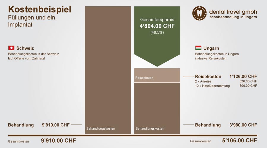 Preisvergleich Füllungen und ein Implantat, Schaubild der Kosten in Ungarn und der Schweiz