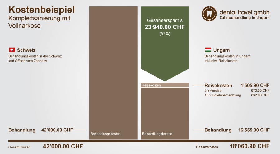 Preisvergleich einer Komplettsanierung mit Vollnarkose, Schaubild der Kosten in Ungarn und der Schweiz