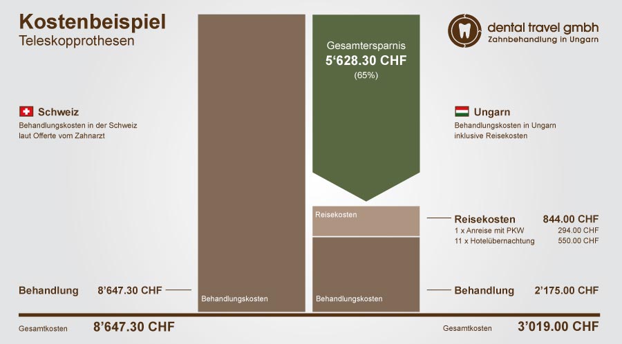Preisvergleich Teleskopprothesen, Schaubild der Kosten in Ungarn und der Schweiz