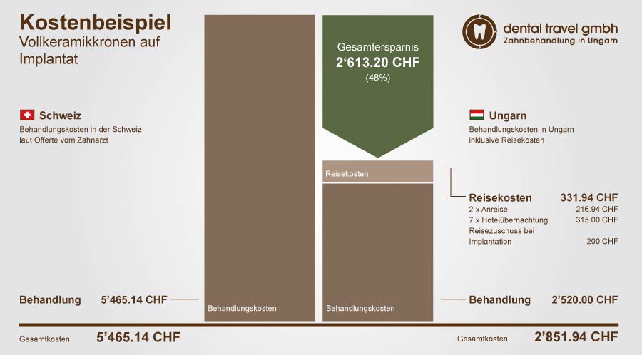 Preisvergleich Vollkeramikkronen auf Implantat, Schaubild der Kosten in Ungarn und der Schweiz