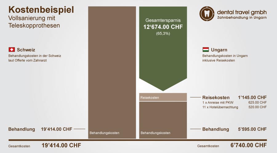 Preisvergleich einer Vollsanierung mit Teleskopprothesen, Schaubild der Kosten in Ungarn und der Schweiz